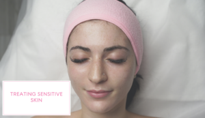 treating sensitive skin